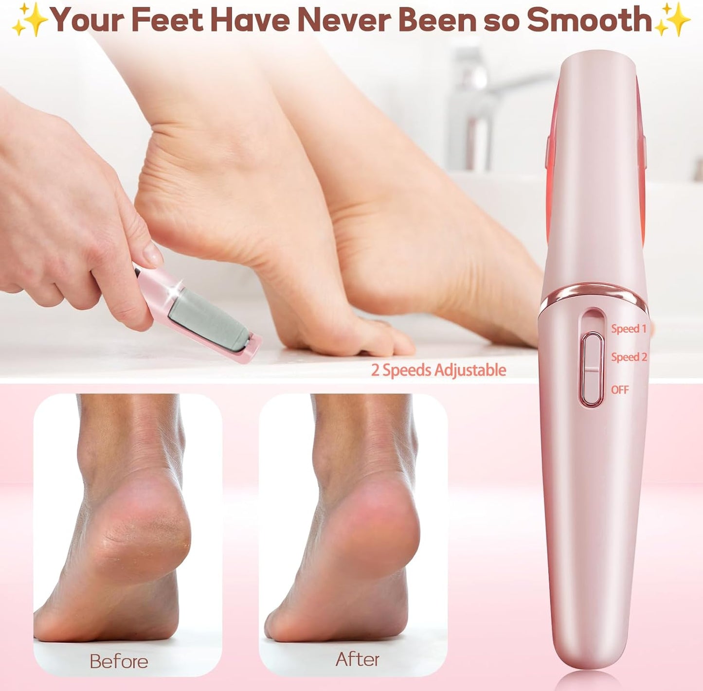 Foot Grinder – Electric Callus Remover